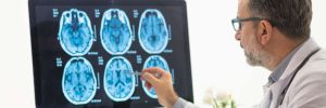 neurology-medical-billing